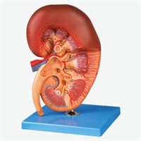 مولاژ کلیه ایستاده 