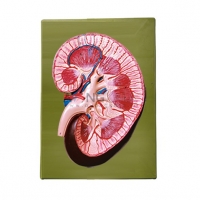 مولاژ کلیه دیواری